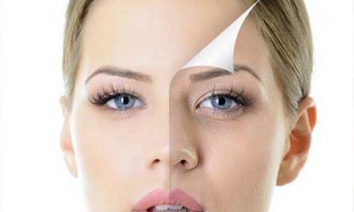 Chemical Peels