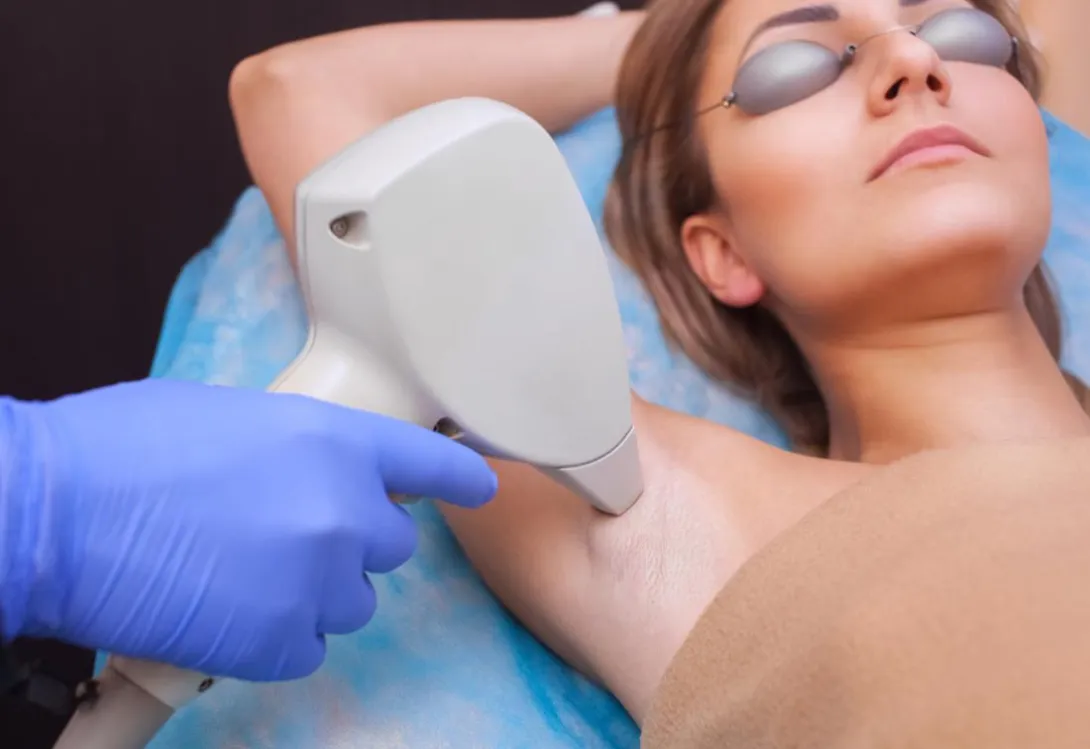 Everything You Need to Know Before Trying Laser Hair Removal